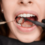 4 Signs You Need a Full Arch Restoration for a Dental Clinic